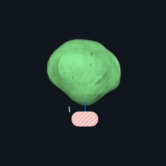 <p>What bone is this?</p>