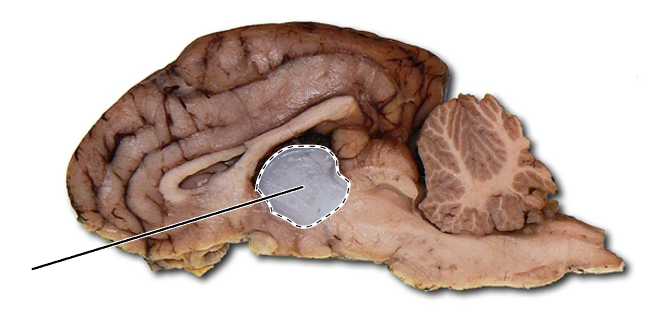 <p>Name the part of the brain that is highlighted.</p>