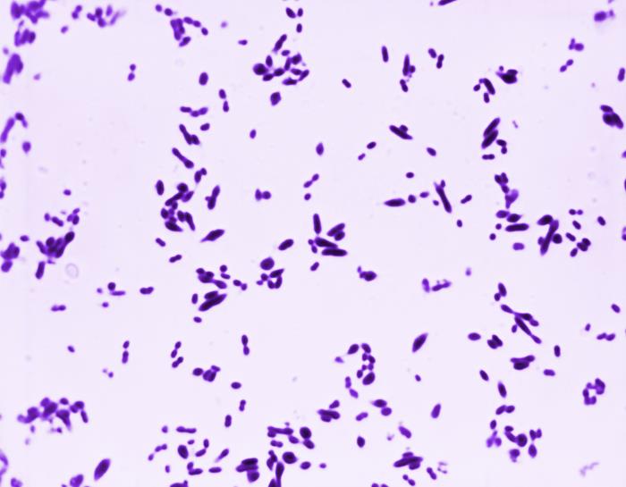 Streptococcus pneumoniae