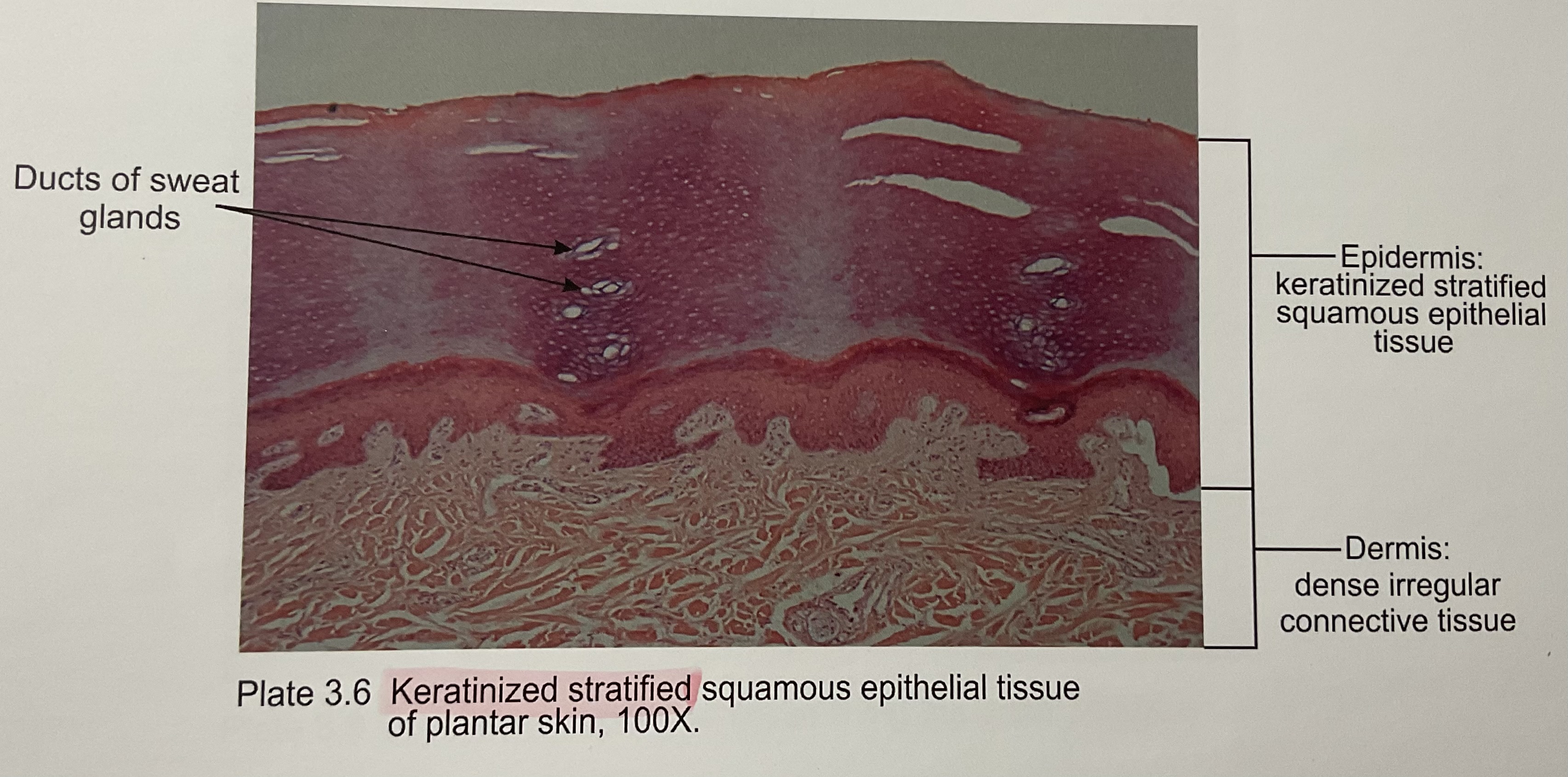 <p>Stratified squamous keratinze</p>