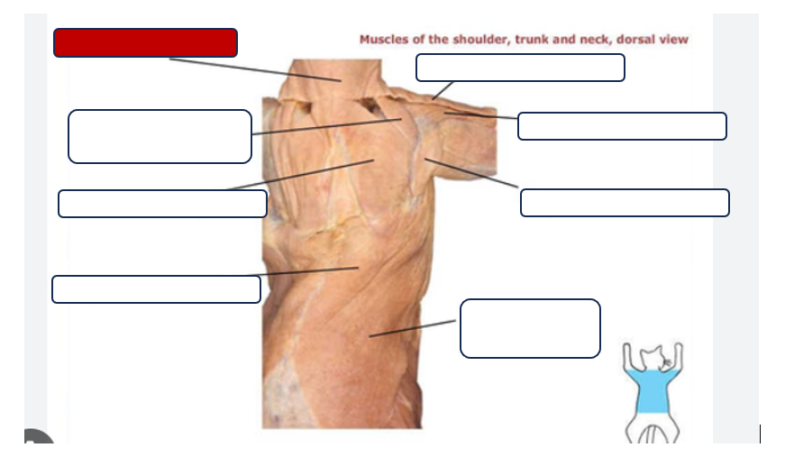 <p>Label the muscle</p>