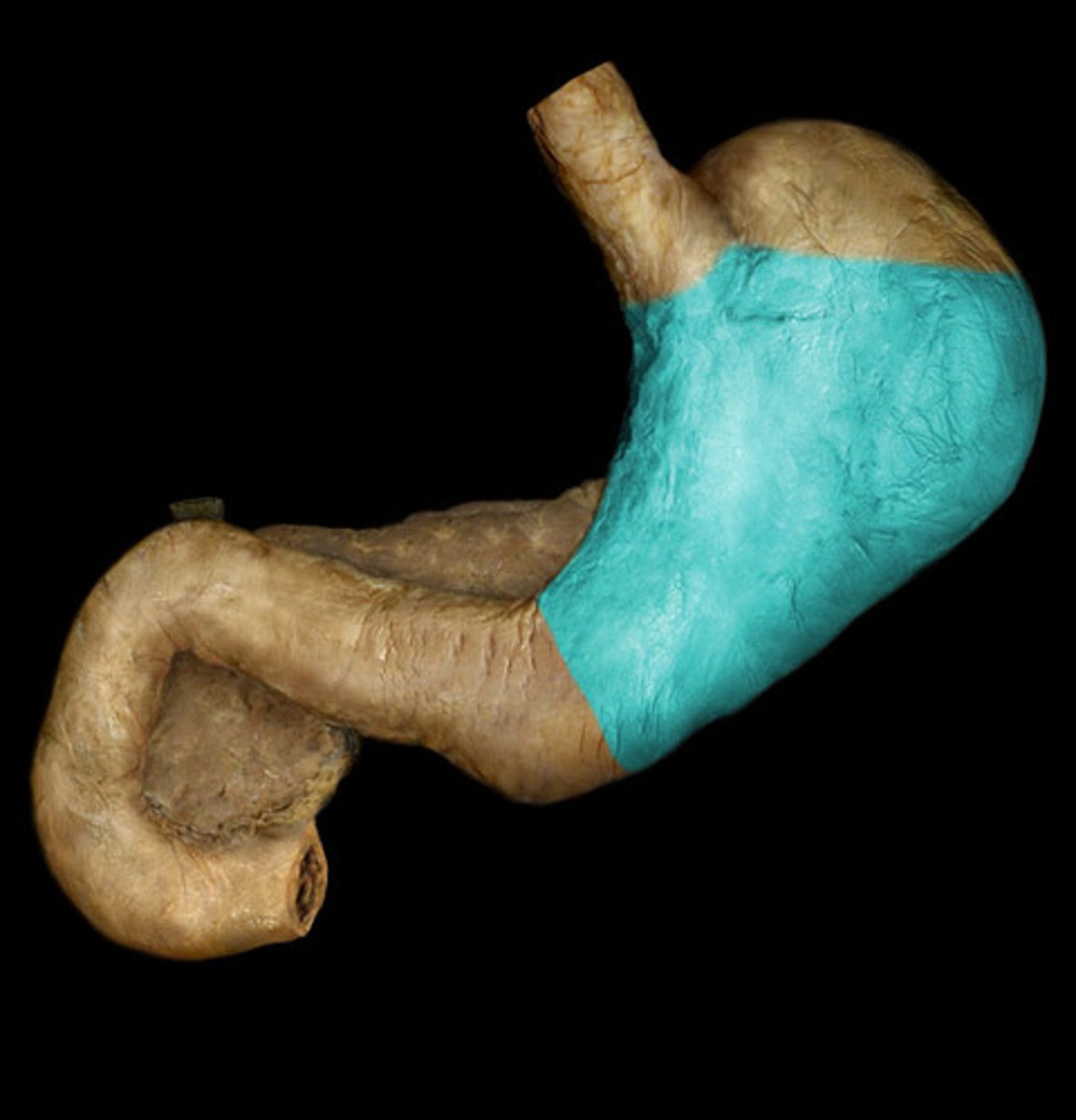 <p>The main central region of the stomach.</p>