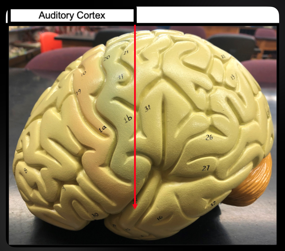 <p>Auditory Cortex</p>