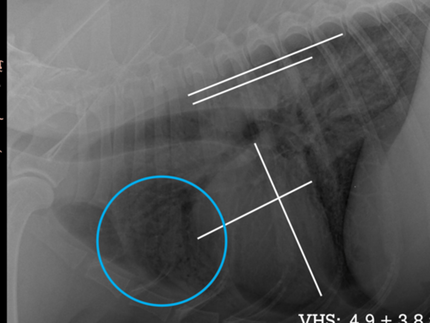 <p>Given the following Rad what do you suspect?</p>