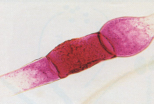 <p>what is this? what fungi group is it for</p>