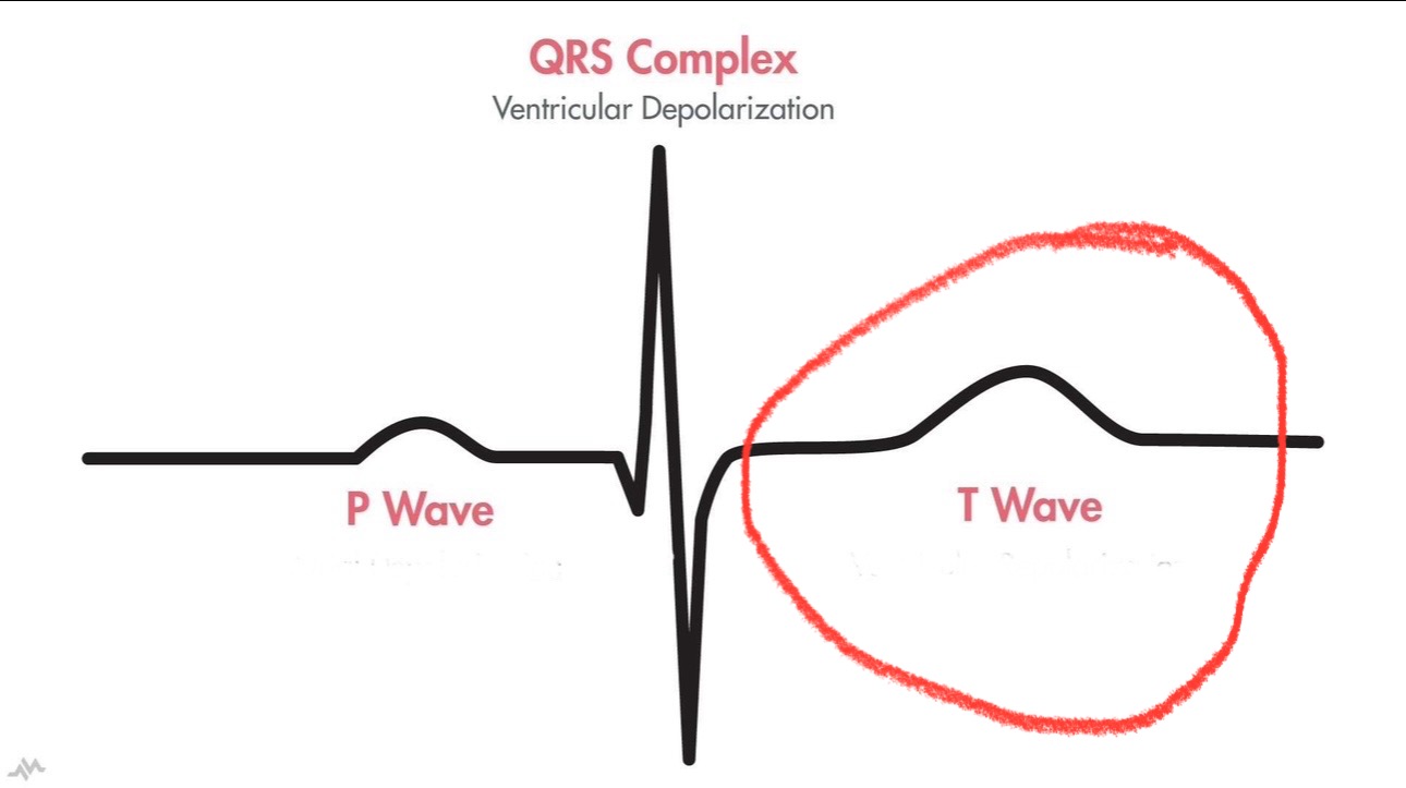 <p>what is the t wave</p>