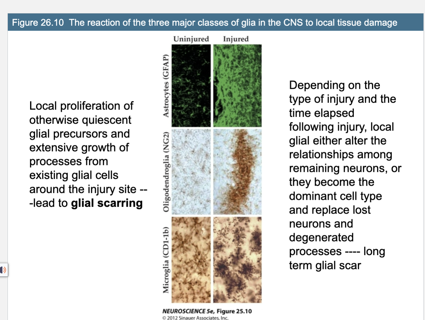 <p><span>Figure 26.10 The reaction of the three major classes of glia in the CNS to local tissue damage</span></p>