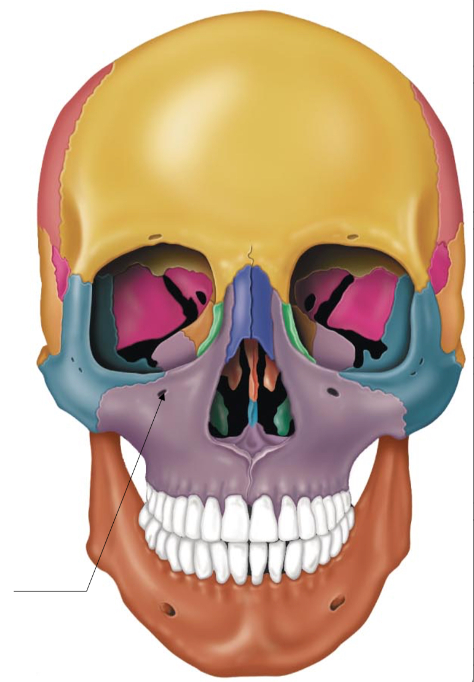 term image