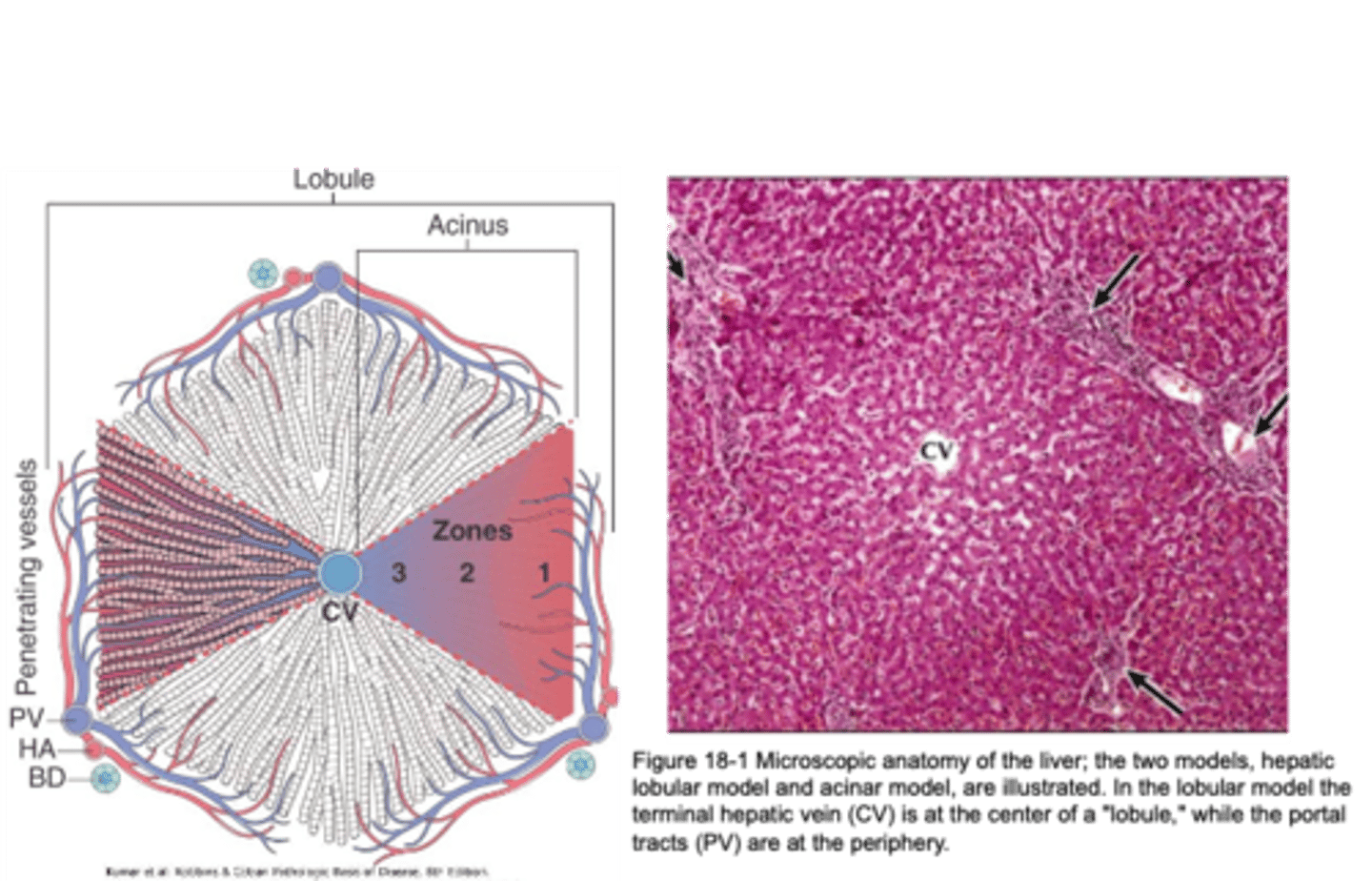 <p>1) periportal <br>2) midlobular<br>3) perivenous/central</p>