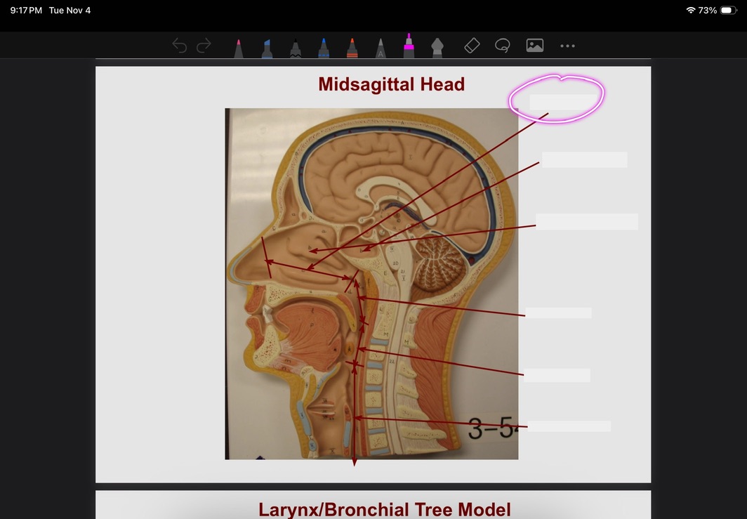 <p>What is this?</p>