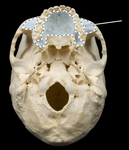 <p>Name this bone.</p><p>(Skull, inferior view).</p>