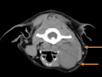 <p>LN evaluation, thoracic imaging </p>