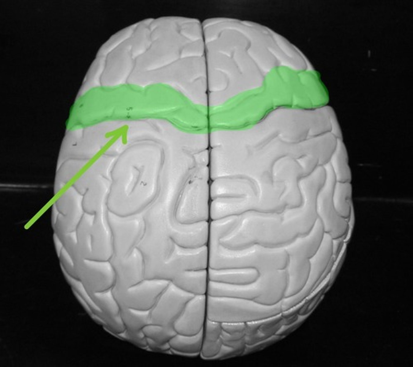 <p>Contains the primary MOTOR cortex</p>