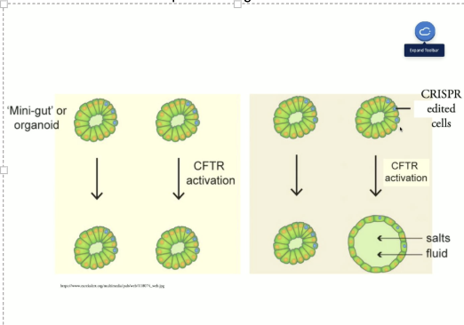 <p>Cystic Fibrosis example</p>