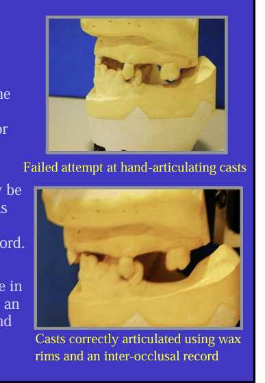 <p>It may be necessary to pre fill those edentulous areas with blocks of wax - called <strong>occlusal rims</strong> and then take an<strong> inter-occlusal record </strong></p><p><strong>occlusal rims </strong>need to be <strong>trimmed </strong>to shape in the mouth first and can then be used with an inter-occlusal record to articulate upper and lower casts on an articulator </p>