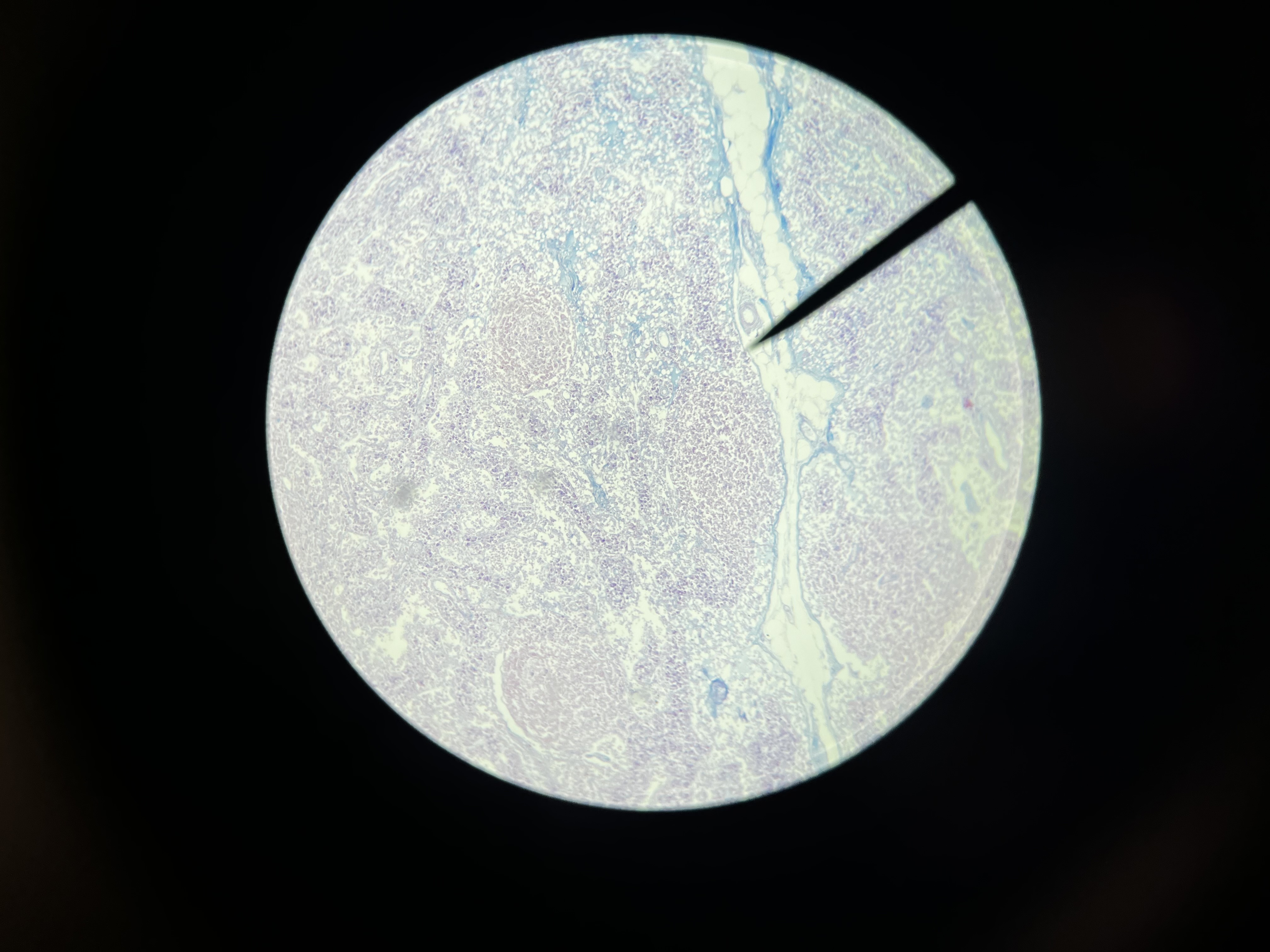 <p>What lymphoid organ is this</p>