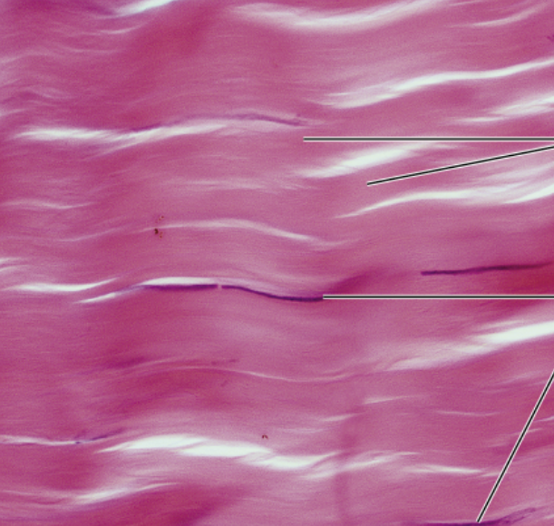 <p>function- attaches muscle to bone/muscle or bone to bone, withstands stress from one direction</p><p>location- tendons, most ligaments, aponeuroses</p>