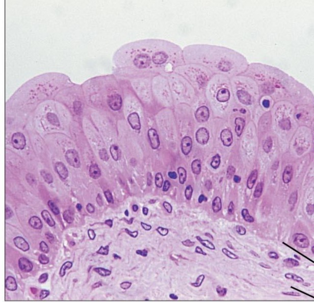 <p>What type of tissue is this </p>
