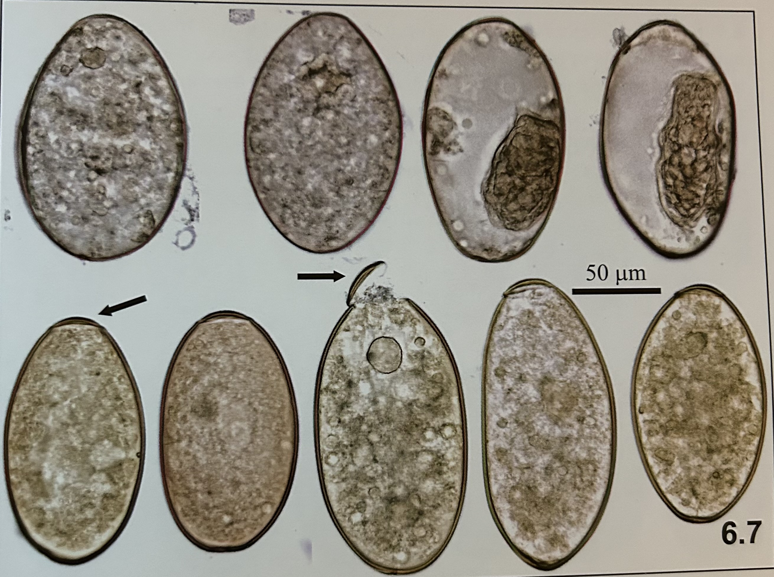 <p>structures of Fasciolopsis buski (egg)</p>