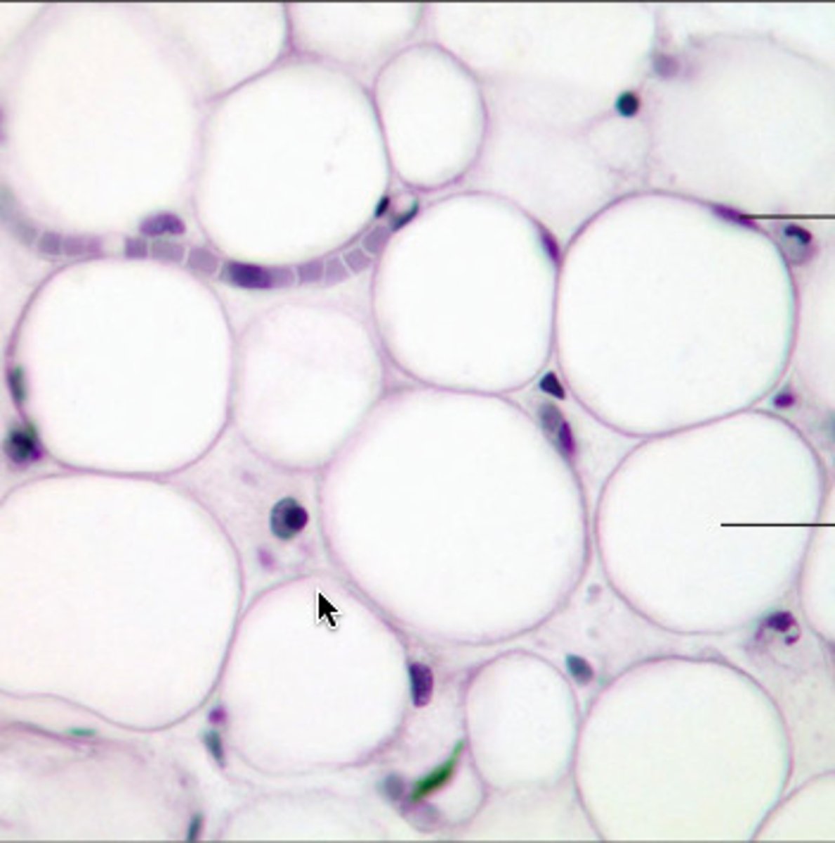 <p>closely packed adipocytes; acts as storage depots for fat with little cellular matrix</p><p>- rapid storage and mobilization of lipid molecules</p><p>- cushion and protection</p><p>- found cushioning around the kidneys and cushioning the back of the eye</p>