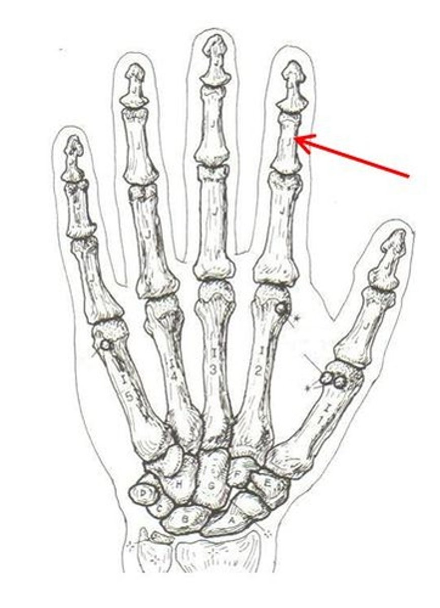 <p>ID bone</p>