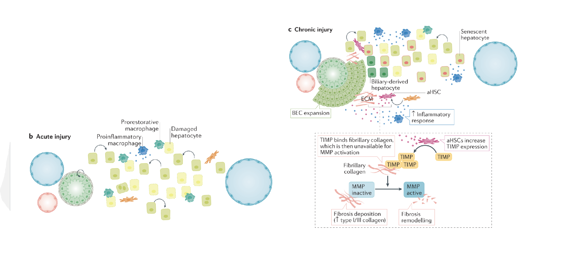 <p>Acute injury → Some hepatocytes are damaged, triggers inflammation from some macrophages and prorestorative function from others</p><p>Chronic injury → BEC expansion, loss of hepatocyte capacity to regenerate (senescence)</p><p>Activated HSCs increase TIMP expression (binds fibrillary collagen; unavailable for MMP activation) </p><p>MMP activation usually leads to decreased fibrosis and collagen </p>