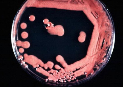 <p>What species of yeast produces a <strong>salmon-pink</strong> colony commonly found in <strong>showers/tubs</strong>?</p>