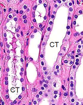 <ul><li><p>End of nephron</p></li><li><p>Urine is concentrated from passive water reabsorption in medulla</p></li><li><p>CT is simple cuboidal epithelium</p></li><li><p>CD is simple columnar epithelium</p></li></ul><p></p>