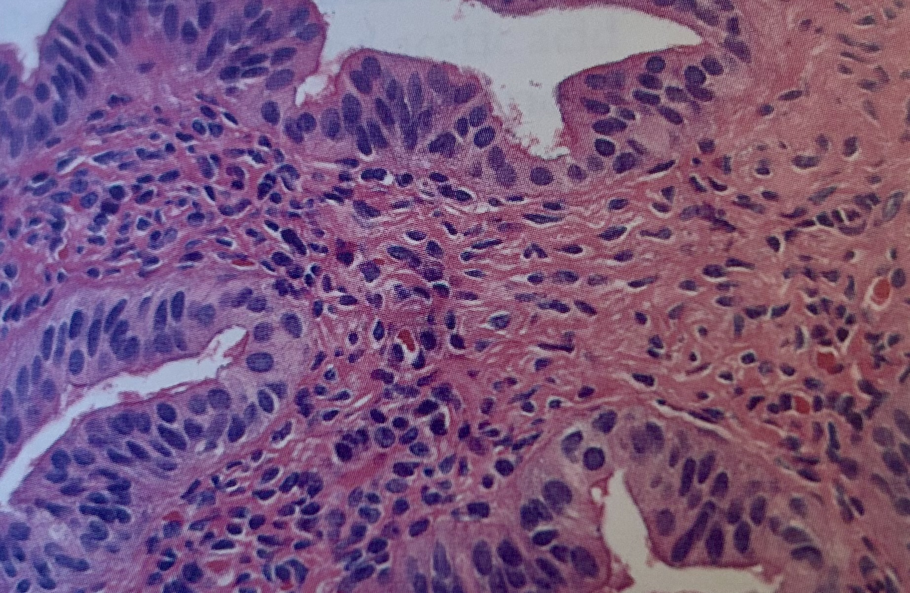 <p>The nuclei in this image indicate:</p><p>a. excellent chromatin demonstration</p><p>b. the use of old hematoxylin</p><p>c. incomplete fixation</p><p>d. overhydration</p>