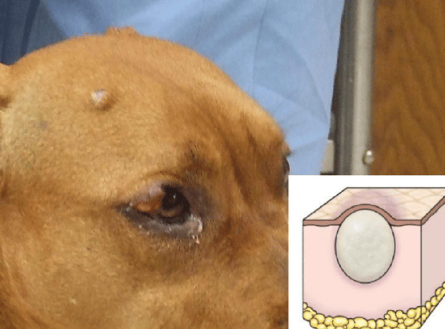 <p>What lesion is this? Is it primary or secondary?</p>