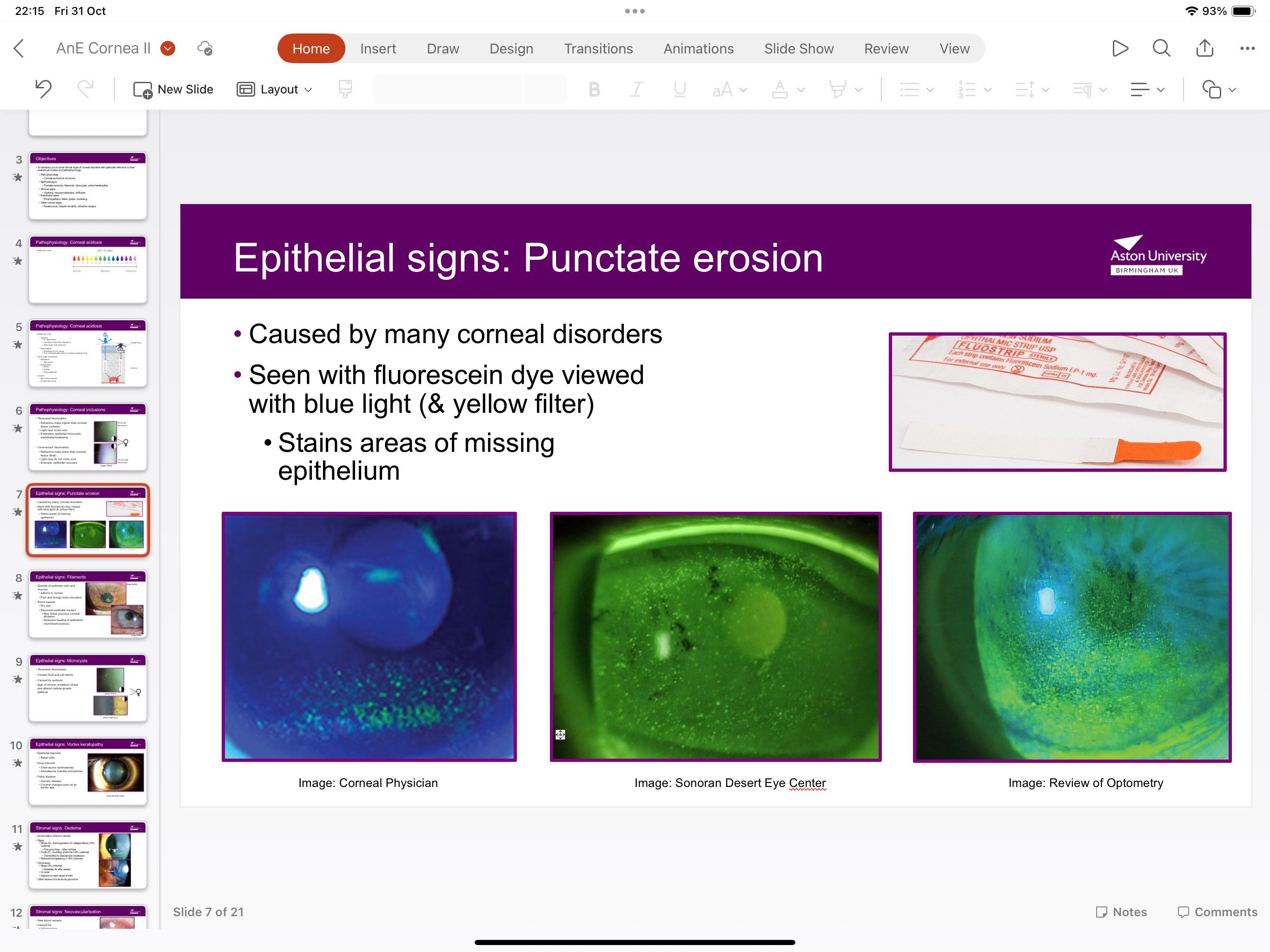<p>Caused by corneal disorders and is seen with flueorescin dye viewed with blue light and yellow filter and it stains areas of missing epithelium</p>