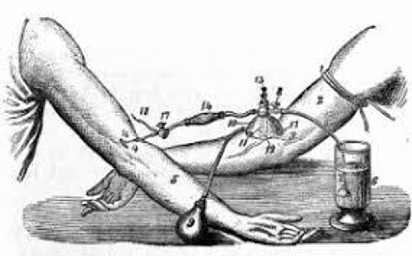 <p>Performed the first successful blood transfusion in humans</p>