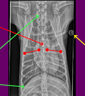 POSITIONING
•No rotation evidenced by sternum being superimposed over the spine
•You can also assess this by the spinous processes sitting in the middle of the vertebral bodies or symmetry in the length of the ribs
ANATOMY
•All required anatomy is included
•CRANIAL Thoracic Inlet
•CAUDAL Diaphragm
•LATERALLY Skin margins
LABELLING
•Correct marker
•Placed in appropriate location