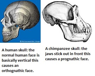 <ul><li><p><strong>The shedding of body hair and the ability for long-distance running (animals that pant are faster but can’t run further distances)</strong></p></li></ul><ul><li><p>Even smaller teeth, jaws, and torsos (as a result of cooking), compared with earlier hominins</p></li><li><p>Less prognathic faces (our faces are more vertical)</p></li><li><p>Increased cranial capacity (Australopithecine—500 cc; H. erectus—1,000 cc), vertical forehead, and thicker skulls</p></li></ul><p></p>