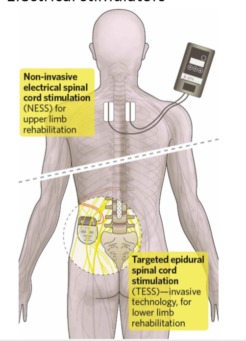 <ul><li><p>even if axons are cute, many neurons below point of damage still function</p></li><li><p>can stimulate nerves despite damage to other parts of  the body</p></li></ul><p></p>