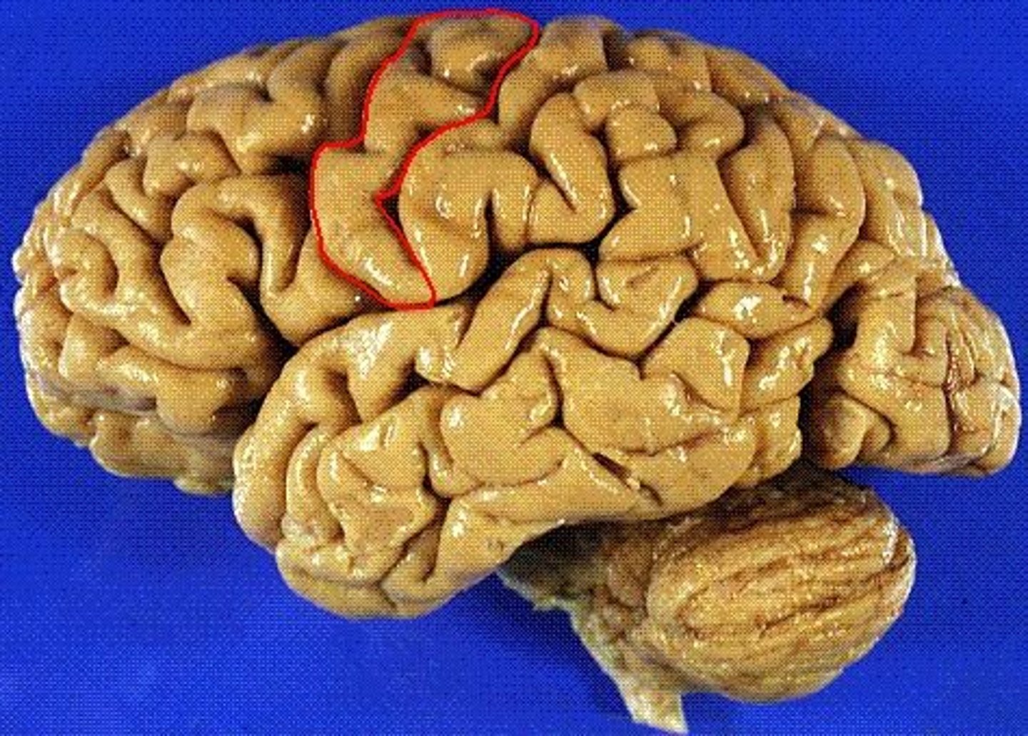 <p>anterior to central sulcus</p>