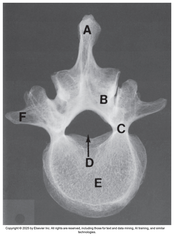 <p>What anatomical structure is letter E?</p>