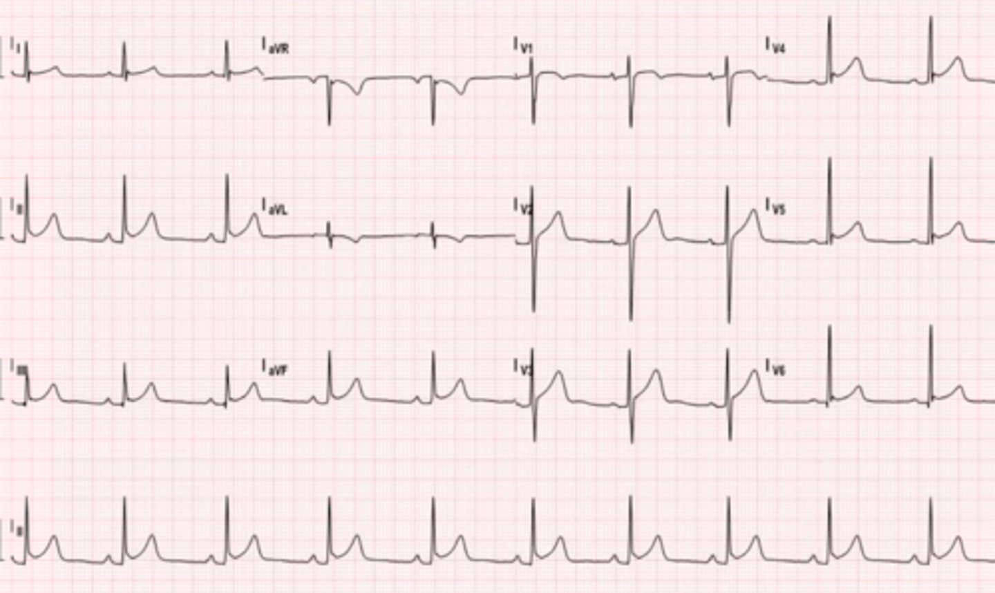 <p>What are the findings</p>
