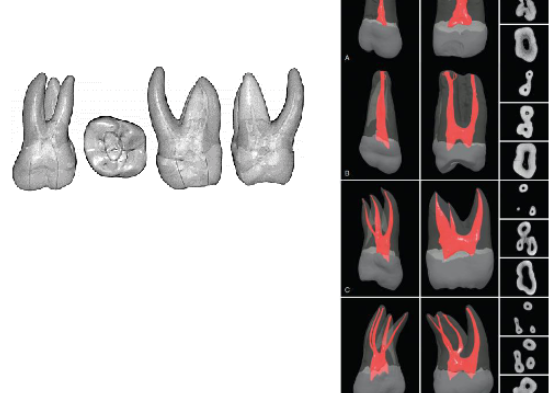 <p>apical to cervical line</p>