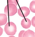 <p>what type of blood cell is this?</p>