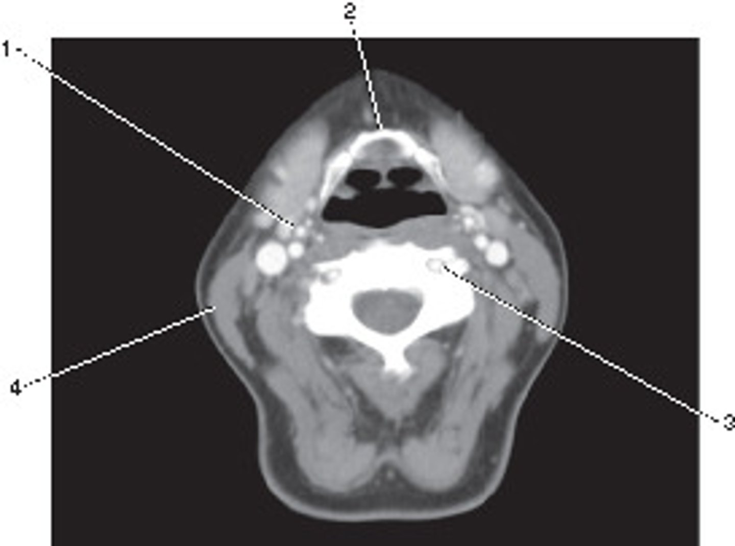 <p>Number 3 corresponds to which of the following?</p>