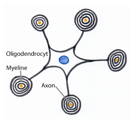<p>= myeliniserende cellen van centraal zenuwstelsel (homoloog van Schwann-cellen in PZS)</p><ul><li><p>eerder kleine cellen met korte uitlopers</p><ul><li><p>uitlopers: gaan over in myelineschede die ze vormen rond axonen</p></li></ul></li><li><p>belangrijkste &amp; frequentste gliacellen in witte stof van CZS</p><ul><li><p>kleur van witte stof: door hoge concentratie van lipiden in myeline</p></li></ul></li><li><p>routine-lichtmicroscopie:</p><ul><li><p>uitlopers van oligodendrocyten &amp; myelineschede niet zichtbaar</p></li><li><p>oligodendrocyten: te zien als kleine cellen met ronde, donkere kern (met veel heterochromatine) met hierrond een dun laagje helder cytoplasma</p></li></ul></li><li><p>in grijze stof: oligodendrocyten kunnen in nauwe associatie liggen met cellichamen van neuronen</p></li></ul><p></p>