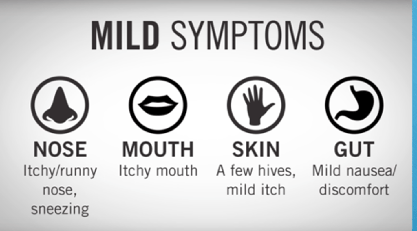 <p>- allergy is within 15 mins of exposure (seen after 1-2 doses of abx)</p><p>- hives (NOT papules)</p><p>- allergy s&amp;s: runny nose, watery eyes, angioedema, facial swelling</p>