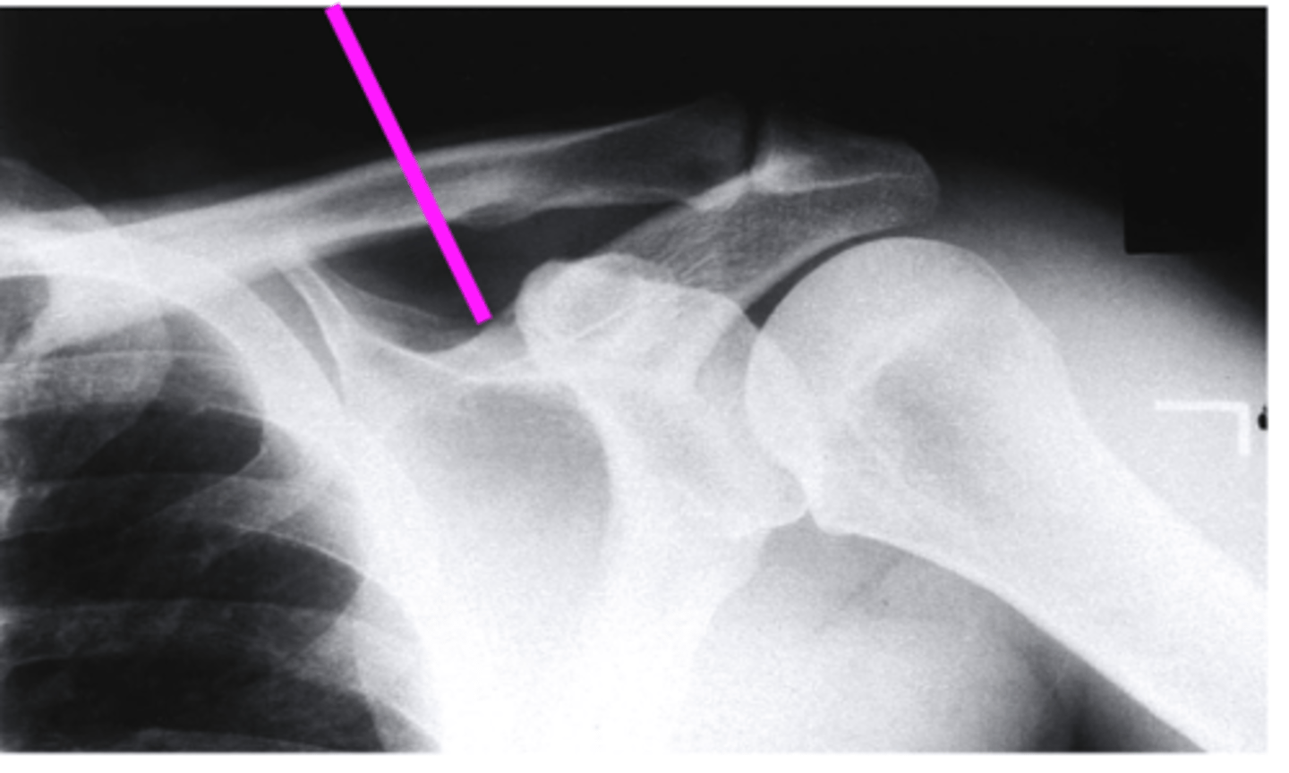 <p>what does the pink line point to?</p>