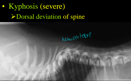 <p>Terms used to describe vertebral curvature</p>