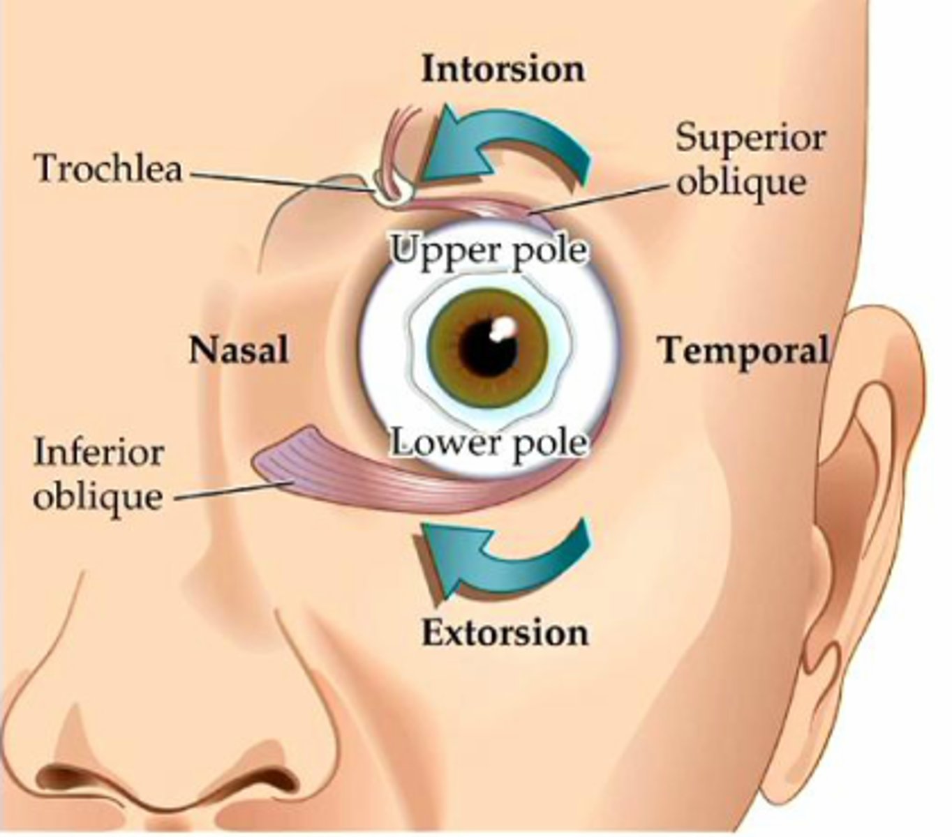 <p>C. A nasal rotation of the eye from the 12 o'clock position</p>