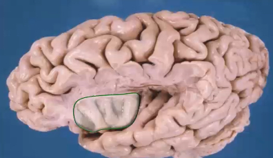 <p>integrates sensory, affective, and cognitive components for autonomic responses to pain, pain related learning and memory</p>