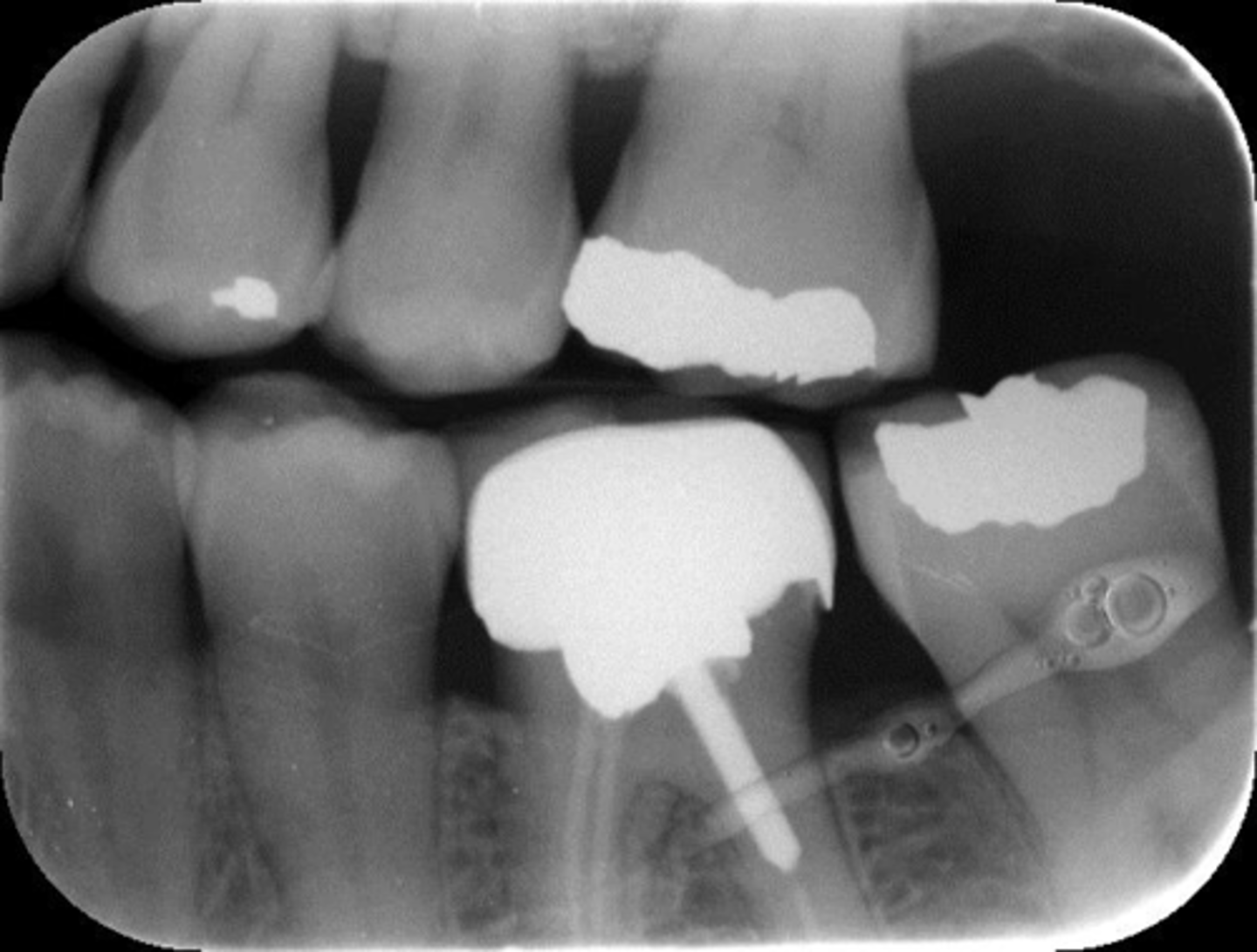 <p>What is this error?</p>