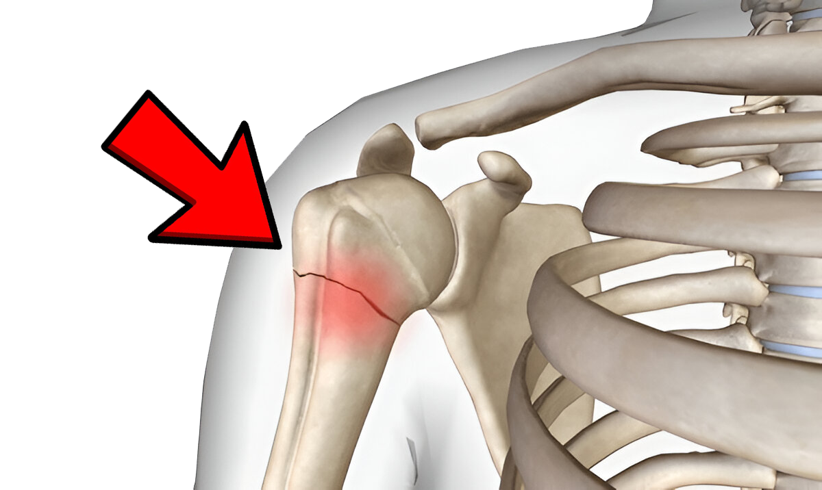 <p>name this bone or bone marking</p>