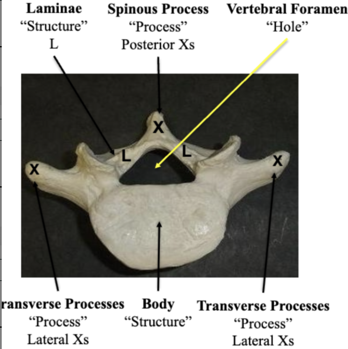 <p>Vertebral Foramen </p>